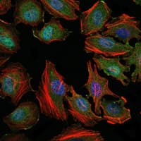 MAP3K5 / ASK1 Antibody (clone 2E4)
