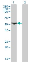 CDADC1 Antibody (clone 1A2)
