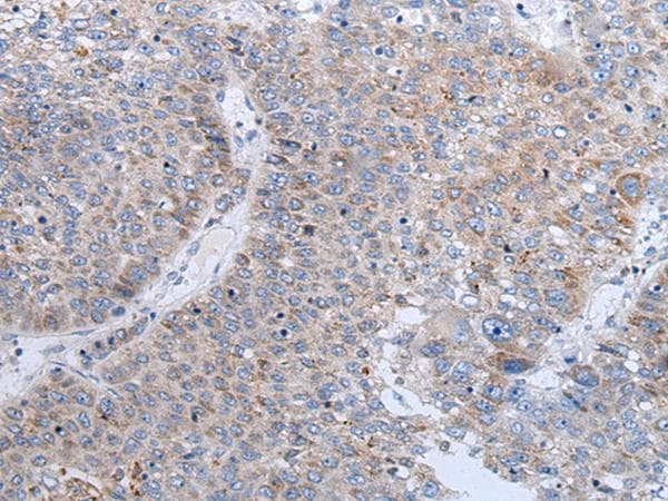ENPP2 / Autotaxin Antibody