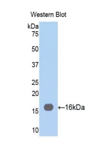 FSCN1 / Fascin Antibody (aa277-396)