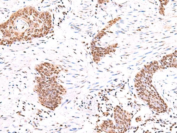 BAF53B / ACTL6B Antibody