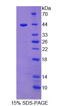 Rat ADAMTS5 Protein (Recombinant His)