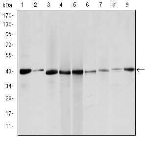 IHC-plus™ ACTA2 / Smooth Muscle Actin Antibody (clone 1H8)