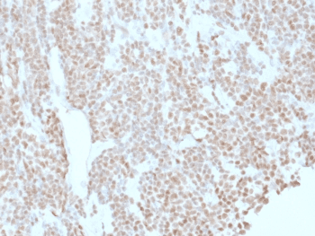 BCL6 Antibody (clone BCL6/1527)