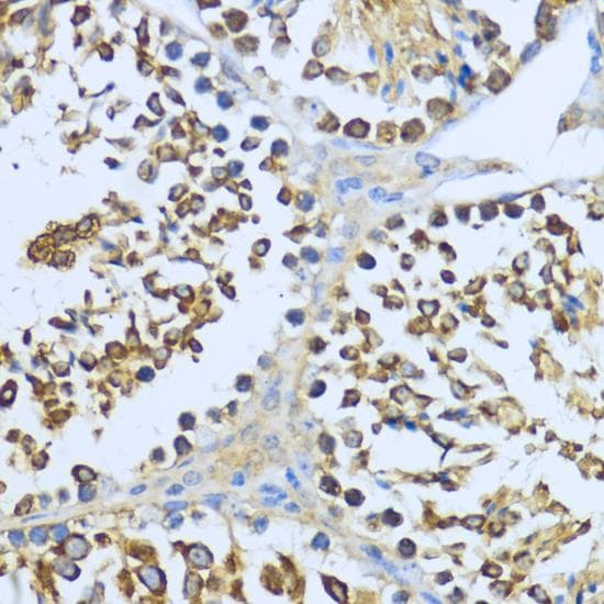 HSP90AA1 / Hsp90 Alpha A1 Antibody