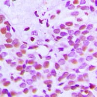 Histone H3 Antibody (Acetyl-Lys18)