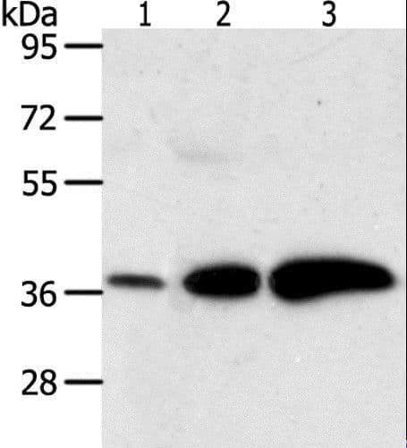 DDH / AKR1C1 Antibody