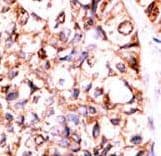 Polyclonal Rabbit anti-Human PPP5C Antibody (aa445-475, IHC, WB)