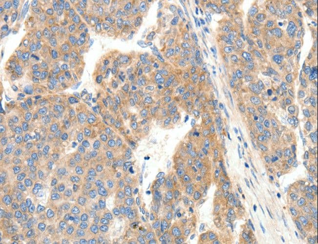 COL4A1 / Collagen IV Alpha1 Antibody