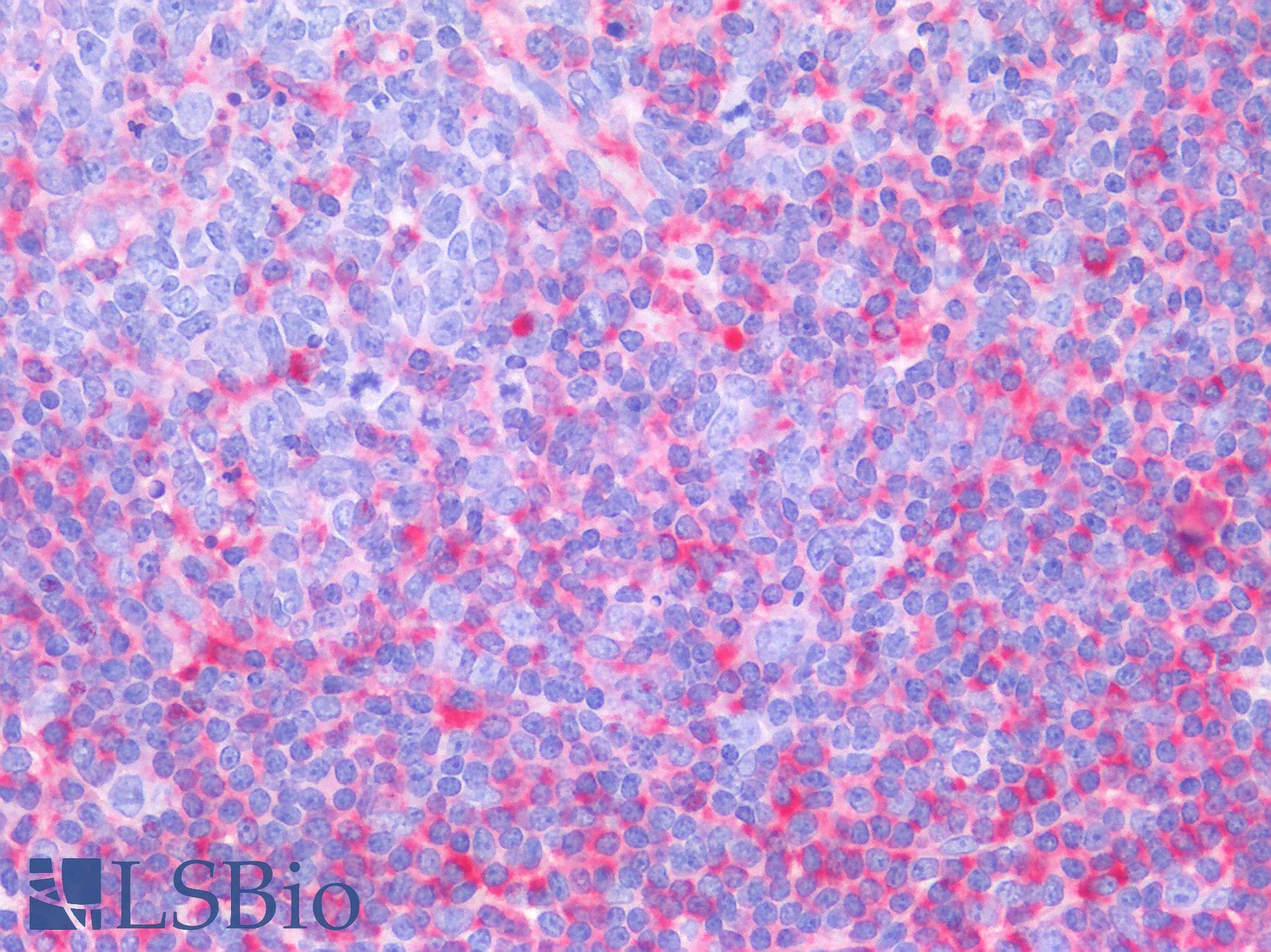 PathPlus™ MVP / VAULT1 Antibody (clone 2H3-1A6)