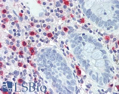 IHC-plus™ Tpsb2 / Tryptase Beta 2 (Mouse Antibody