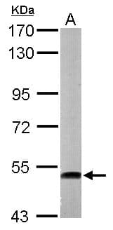 ATP6V1H Antibody (aa169-444)