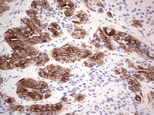 Monoclonal Mouse anti-Human KRT19 / CK19 / Cytokeratin 19 Antibody (clone OTI5F4, aa240-390, IHC, WB)