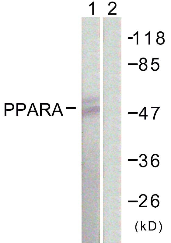 PPARA / PPAR Alpha Antibody (aa6-55)