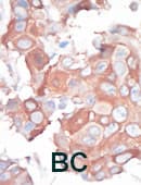 MAP3K1 / MEKK1 Antibody (aa1145-1176)