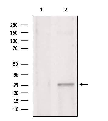 Polyclonal Rabbit anti-Human CHCHD6 Antibody (IHC, WB)