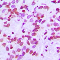 Polyclonal Rabbit anti-Human FAM111B Antibody (Internal, IHC, WB)