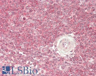 IHC-plus™ IL7R / CD127 Antibody