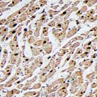 Polyclonal Rabbit anti-Human MAPKAPK3 Antibody (C-Terminus, IHC, IF, WB)
