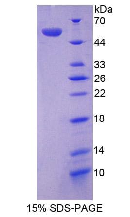Mouse AGT / Angiotensinogen Protein (Recombinant His-S)