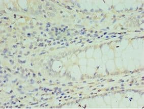 SOX6 Antibody (aa1-74)