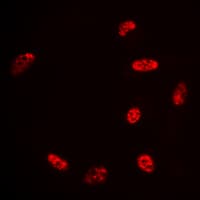 Histone H2B Antibody (Acetyl-Lys15)