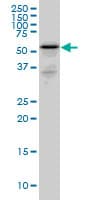 Monoclonal Mouse anti-Human RHCG Antibody (clone 5A4, IHC, WB)