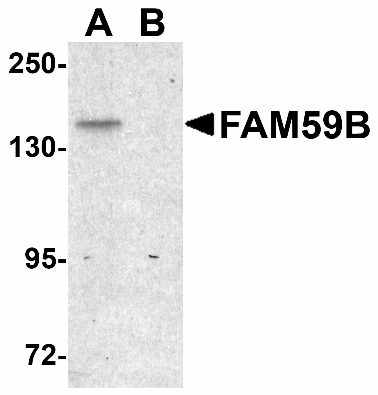 IHC-plus™ Polyclonal Rabbit anti-Human GAREML Antibody (IHC, IF, WB)
