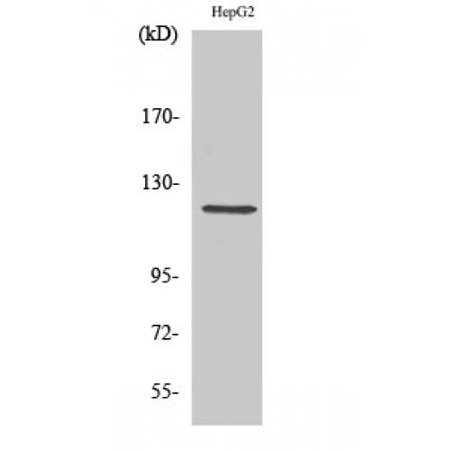 Polyclonal Rabbit anti-Human NRP1 / Neuropilin 1 Antibody (Internal, IHC, WB)