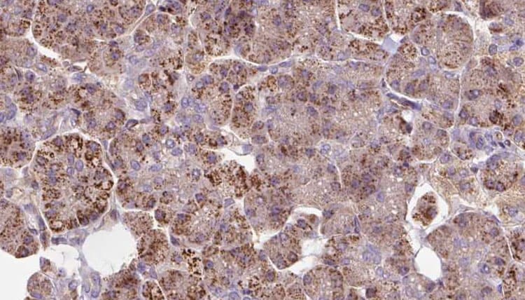 Polyclonal Rabbit anti-Human P3H3 / LEPREL2 Antibody (IHC, WB)