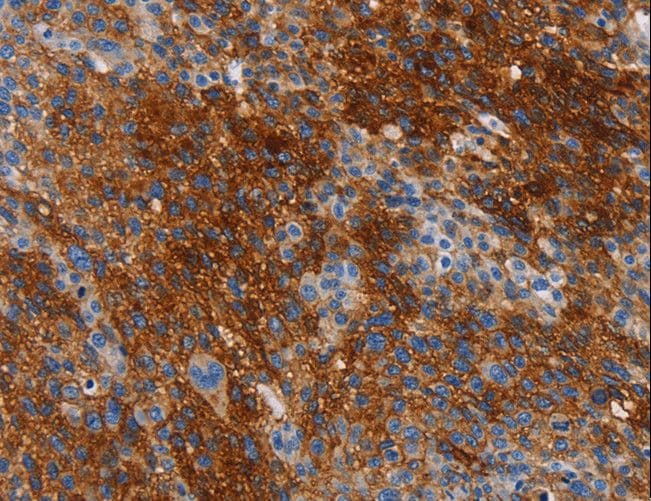 CA9 / Carbonic Anhydrase IX Antibody