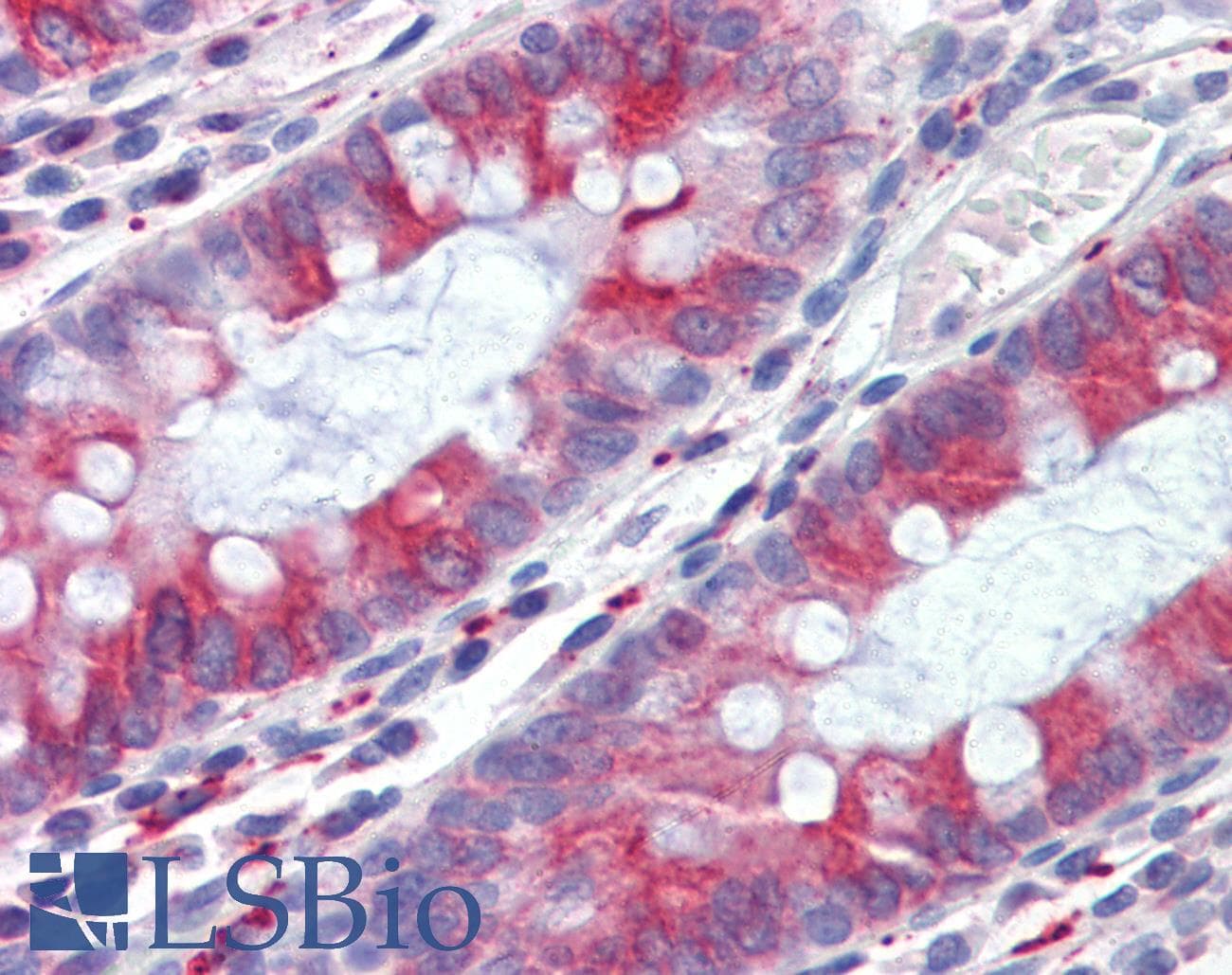 PathPlus™ TUBB / Beta Tubulin Antibody