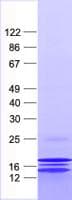Human RPL31 / Ribosomal Protein L31 (Recombinant His, N-Terminal)