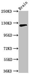 C11orf9 / MRF Antibody