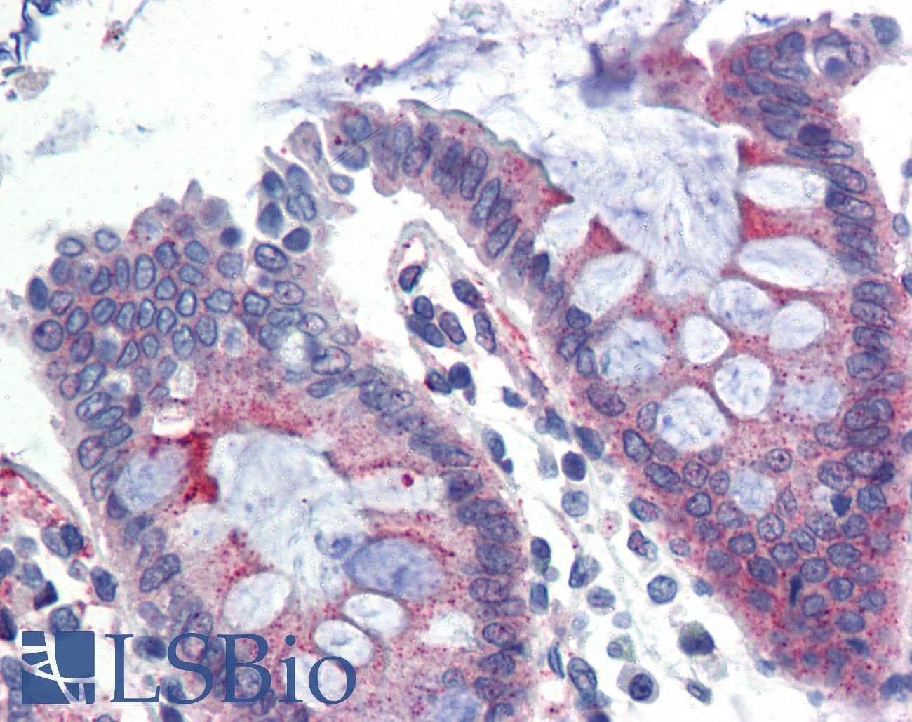 KLB / Beta Klotho Antibody (Internal)