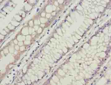 Polyclonal Rabbit anti-Human GCSAML / C1orf150 Antibody (IHC)