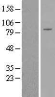 DGKB / DGK Beta Protein (Over-Expression Lysate Myc-DDK (Flag))