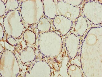 Polyclonal Rabbit anti-Human FOXR2 Antibody (IHC, WB)