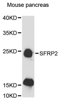 Polyclonal Rabbit anti-Human SFRP2 Antibody (WB)