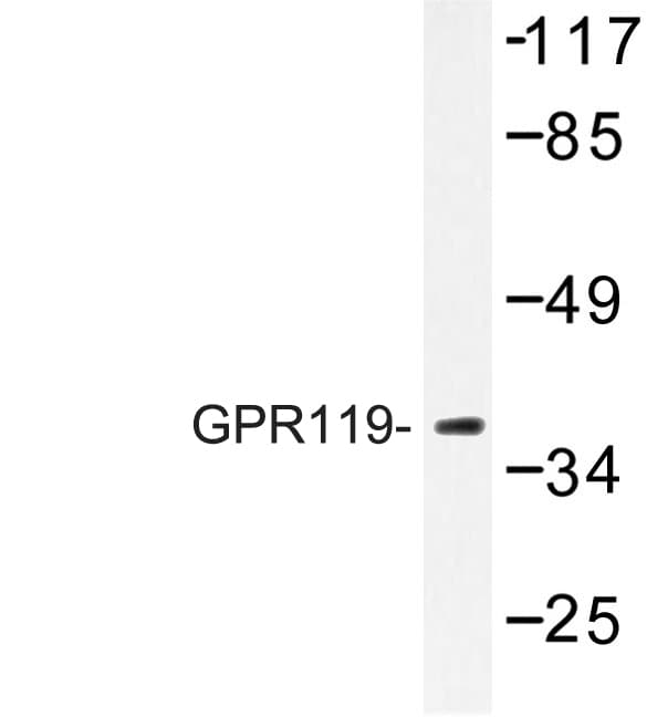 GPR119 Antibody (Val227)
