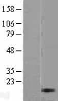Human MRPL17 Protein (Over-Expression Lysate Myc-DDK (Flag))