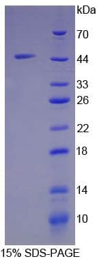 Mouse Ribonuclease A / RNASE1 Protein (Recombinant His-GST)