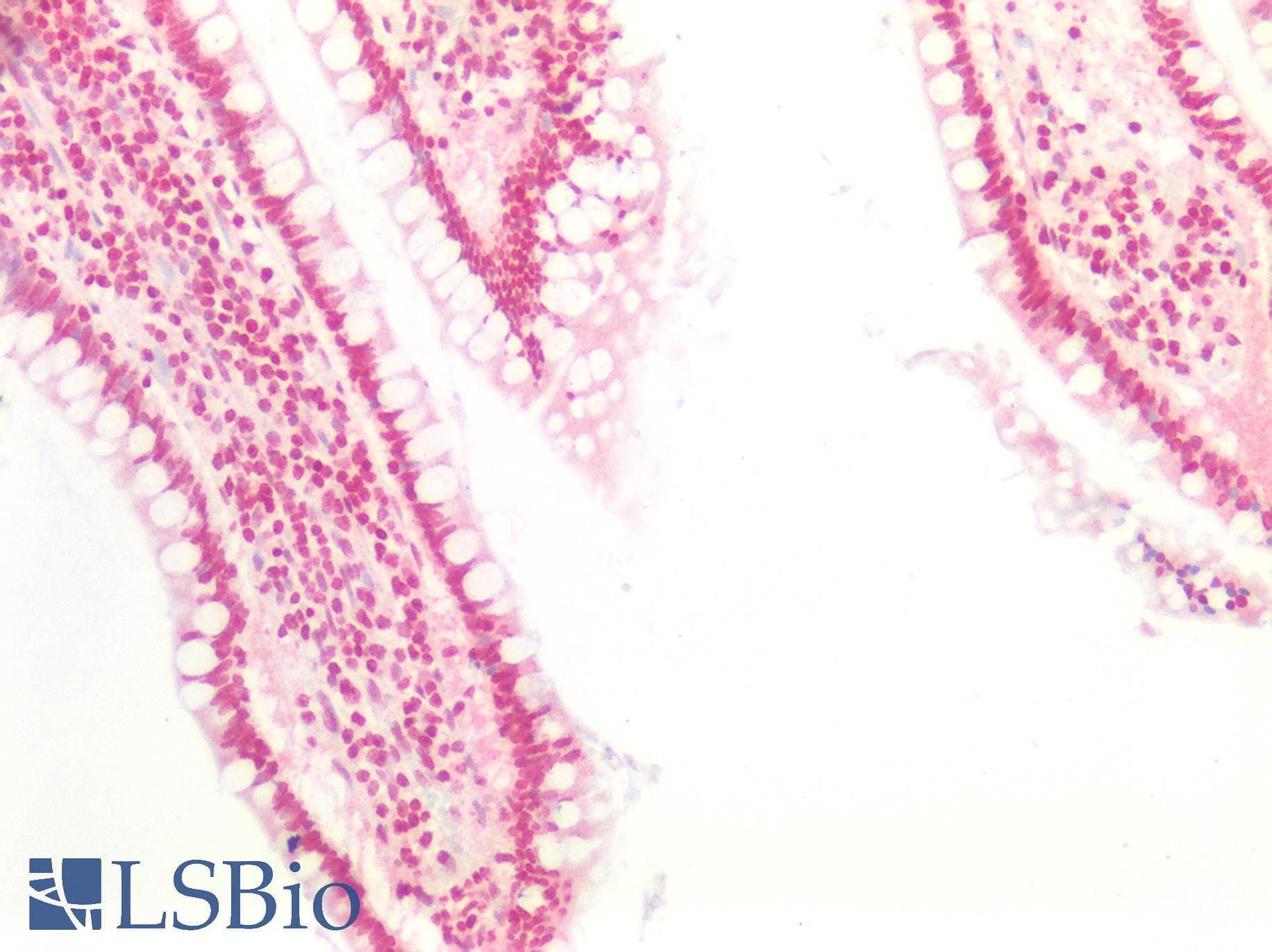 IHC-plus™ TTF1 / Txn Termination Factor Antibody