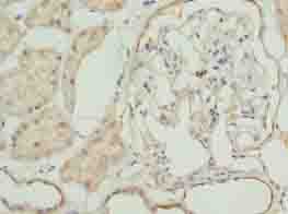 MCAD / ACADM Antibody