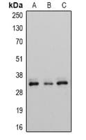 ECI1 / DCI Antibody (C-Terminus)