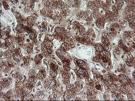 Monoclonal Mouse anti-Human TRIM44 Antibody (clone OTI1E10, IHC, IF, WB)