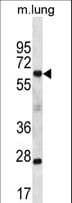 SP2 Antibody (aa498-526)
