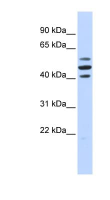 HSPBAP1 Antibody (aa180-229)