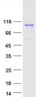 Human RANBPM Protein (Recombinant Myc-DDK (Flag))