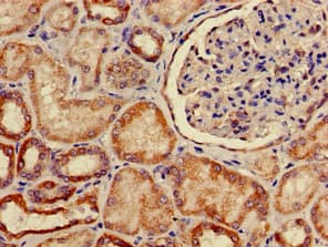 SLC2A9 / GLUT9 Antibody